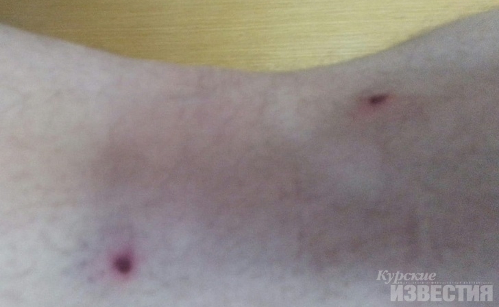 Курск. Организатор фотосессии: «Целился в голову, потом опустил пистолет и начал стрелять по ногам» Курск. Организатор фотосессии: «Целился в голову, потом опустил пистолет и начал стрелять по ногам»