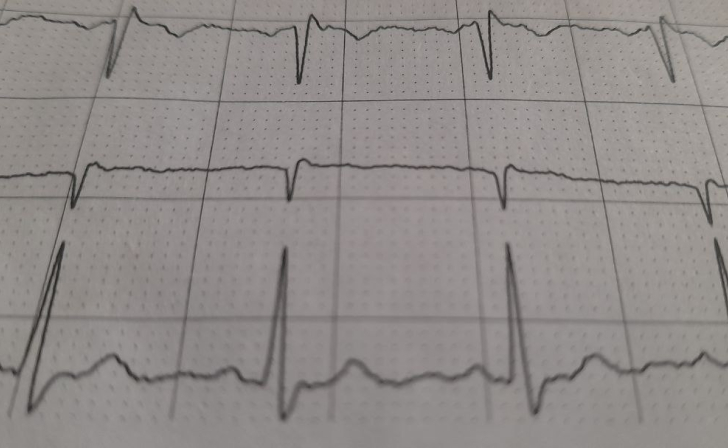 Для пожилых участников проекта «Курское долголетие» провели занятие «Что надо знать об инсульте?»