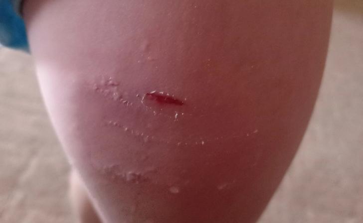 Курянка пожаловалась, что во дворе дома на Ольшанского бездомные собаки нападают на детей