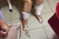 На двух курянок напала стая собак на улице Хуторской