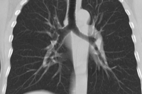 Курская журналистка рассказала, как ее больную маму игнорировали врачи