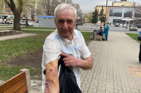 Курская прокуратура проводит проверку из-за нападения стаи собак на людей